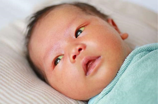 تاثیر شیر مادر بر زردی نوزاد